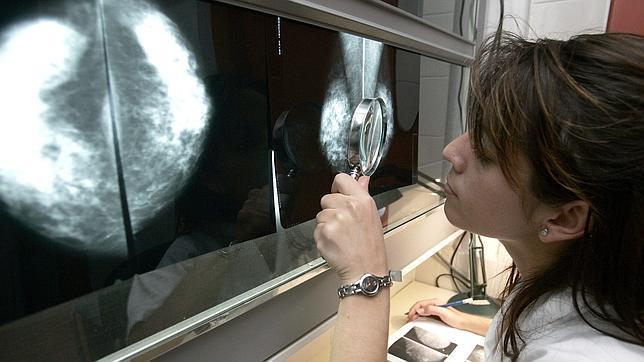 Una radióloga observa una mamofrafía en busca de lesiones sospechosas de tumor