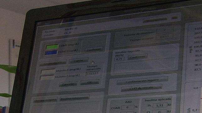 Prueban un modelo de páncreas artificial en veinte pacientes