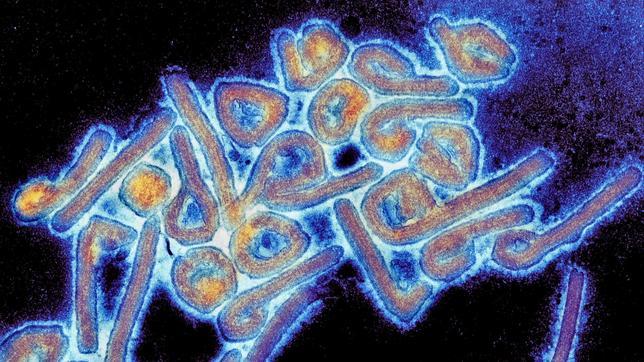 Fotografía de microscopio electrónico de partículas del virus Marburgo