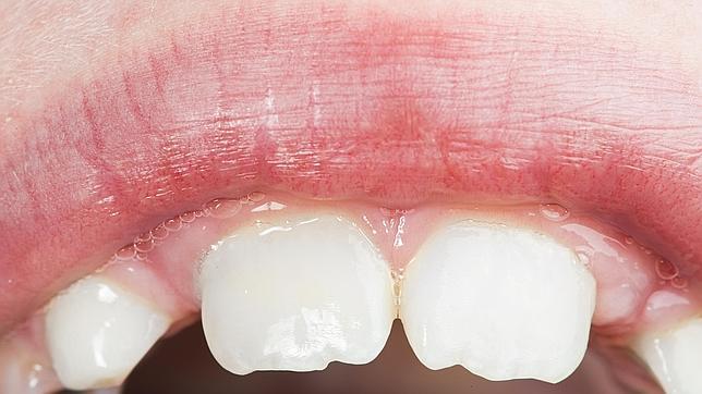 Consejos Para Cuidar Los Dientes Y Encias De Los Mas Pequenos
