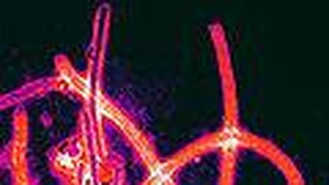 Virus del Ébola