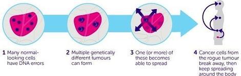 origen del adenocarcinoma de próstata