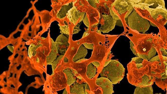 Los microbios sufren cambios que a veces les hacen invulnerables frente a medicamentos