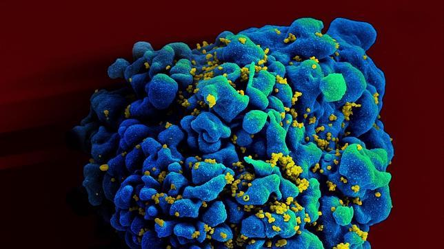 Virus del sida