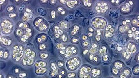 Microbios sobreviven año y medio en el espacio