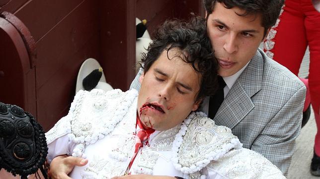 Miguel Abellán ha perdido seis dientes y casi no puede hablar tras la cogida