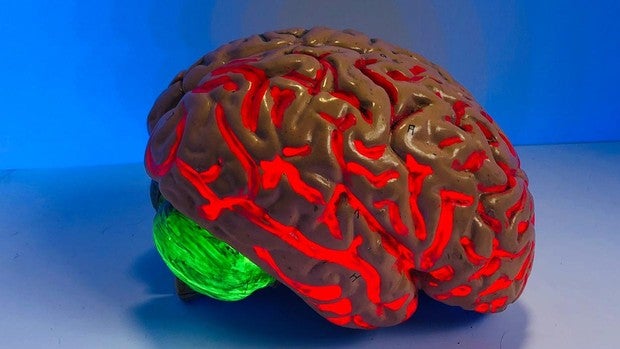 cerebro-1-kVMF--620x349@abc