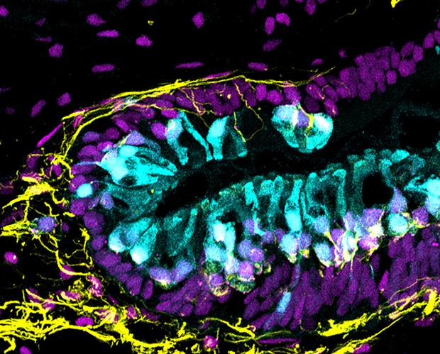 Imagen del organoide de un oído interno humano. En azul , las células ciliadas o pilosas y células nerviosas (amarillo).