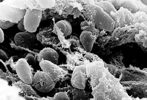 Bacilos de Yersinia pestis, los causantes de la peste