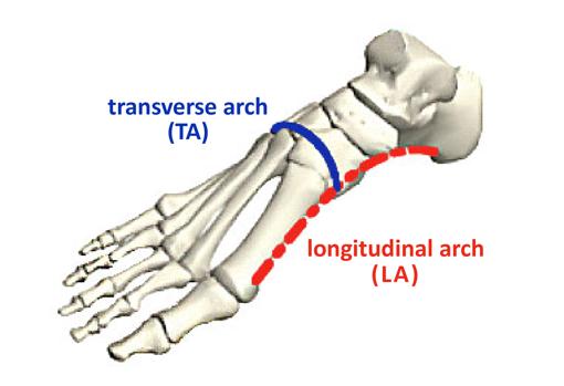 El arco longitudinal ha sido bien estudiado cuando se trata de la rigidez del pie, pero esta investigación encontró que el arco transversal puede ser más importante.