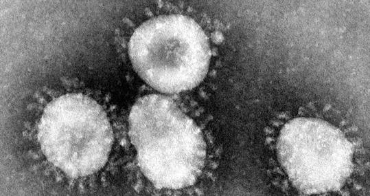 Varios patógenos del grupo de los coronavirus vistos al microscopio electrónico