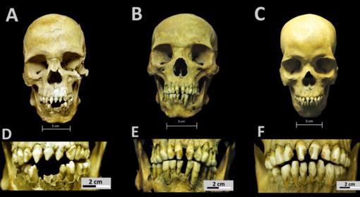 Cráneos y patrones de modificación dental de los tres africanos del Hospital Real San José de los Naturales