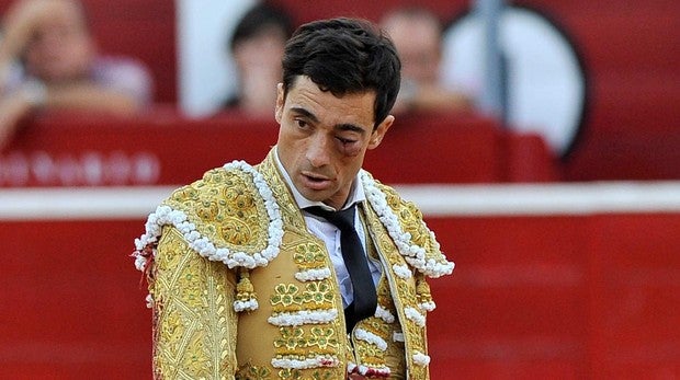 Ureña, con el ojo amoratado y casi cerrado por la hinchazón