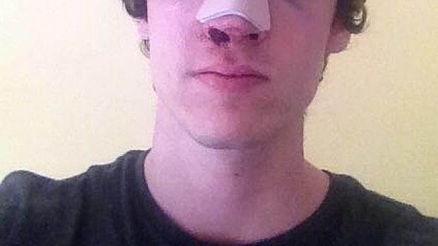 El joven agredido en Malasaña