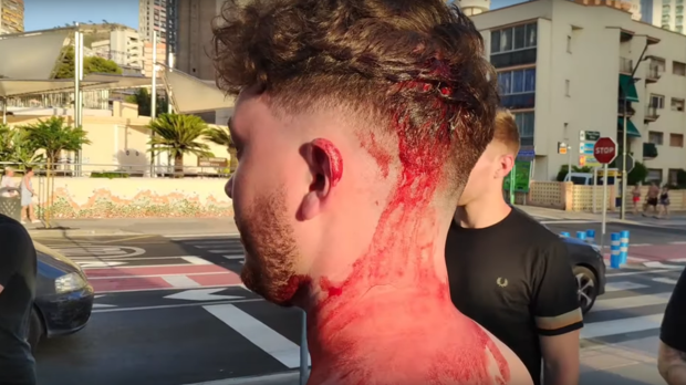 Imagen del agredido en un momento del vídeo
