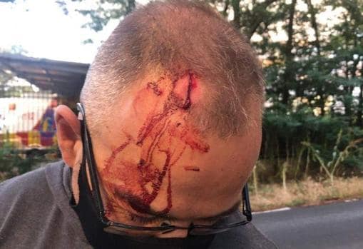 Un hombre con una brecha en la cabeza, tras ser apedreado el domingo