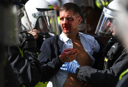 Un hombre herido durante las protesas en Londres