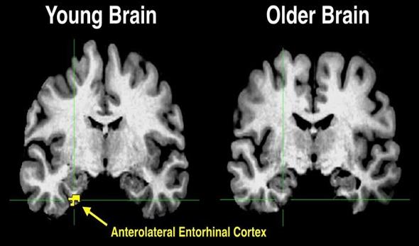 Descenso en la actividad de la corteza entorrinal anterolateral asociado a la edad