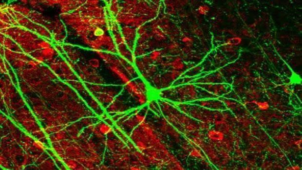 Neuronas