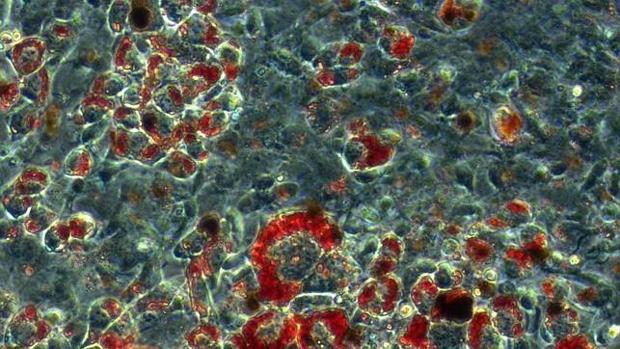 Imagen por microscopía del tejido adiposo marrón