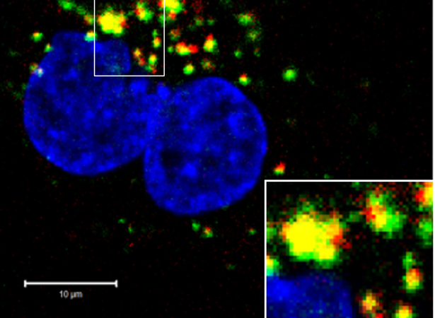El fármaco de ADN (antisentido CpG-STAT3, rojo) penetra en las células de cáncer de próstata humano dentro de los 15 minutos de exposición (antisentido CpG-STAT3, rojo; vesículas intracelulares, verde).