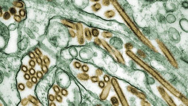Virus de la gripe