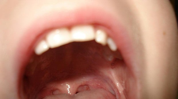 La microbioma es la población de microorganismos, que viven en y dentro de nuestros cuerpos