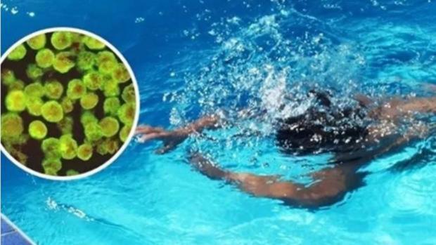 La ameba «comecerebros» se introduce en el cuerpo a través de la nariz