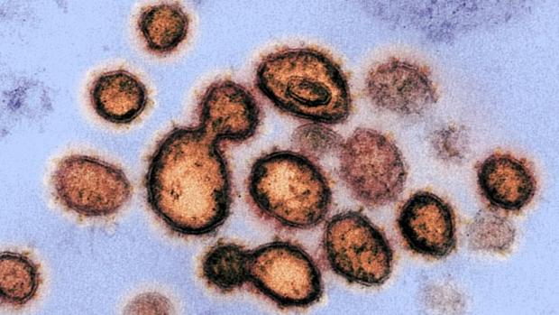 Una investigación australiana demuestra que un fármaco antiparasitario mata al coronavirus en 48 horas