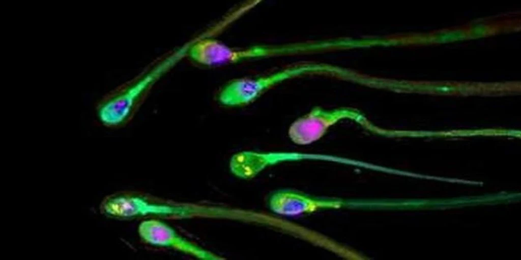 The protein that makes sperm lazy and infertile in men