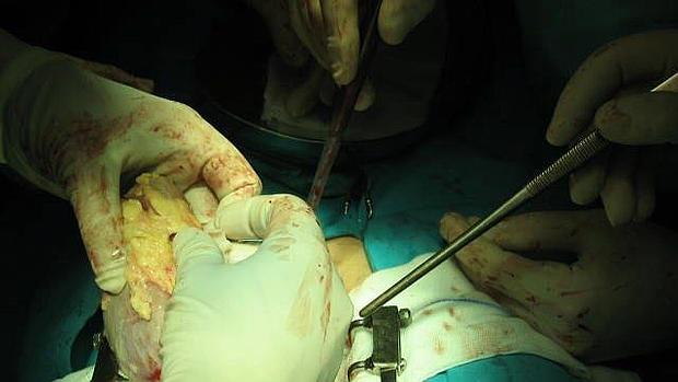 Trasplante de riñón en el hospital Virgen de la Salud de Toledo