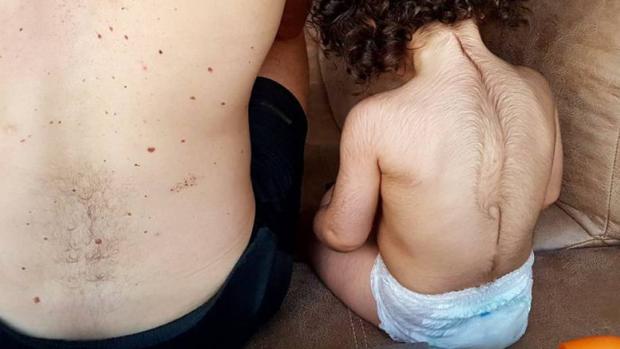 Uno de los bebés afectados junto a su padre