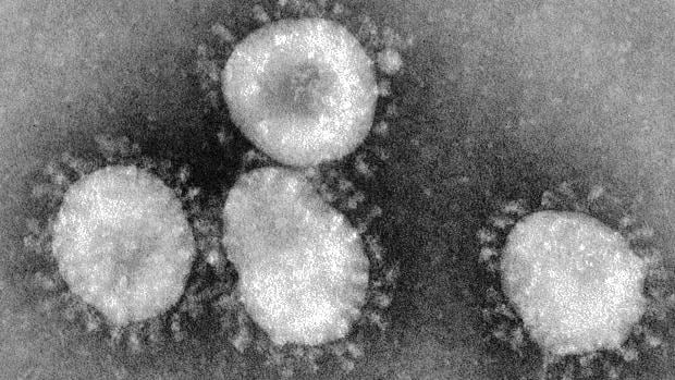 Coronavirus visto desde un microscopio