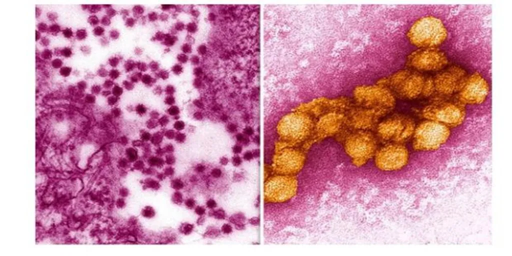 De Cuando Caían «cuervos Muertos» En Nueva York En 1999 Y Era «el Virus ...